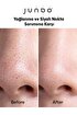 Sebum Dengeleyici Ve Siyah Nokta Önleyici Yüz Temizleme Jeli 200 ml. ürün görseli